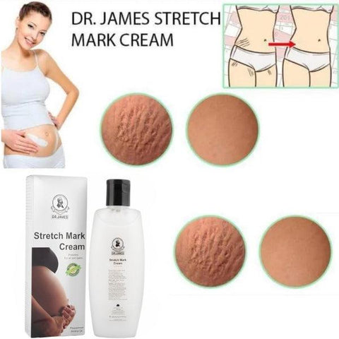 DR.JAMES STRETCH MARK CREAM PEPPERMINT AROMA OIL 12M